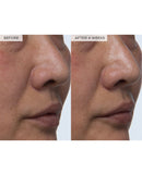 Watermelon Glow PHA+BHA Pore-Tight Toner