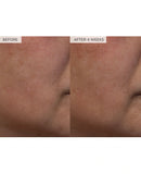 Watermelon Glow PHA+BHA Pore-Tight Toner