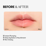 Reedle shot Lip Plumper